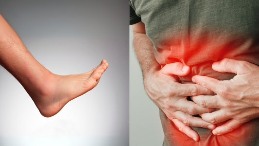 Inflammation: The Root of So Many Health Problems (And How to Cool It Down)