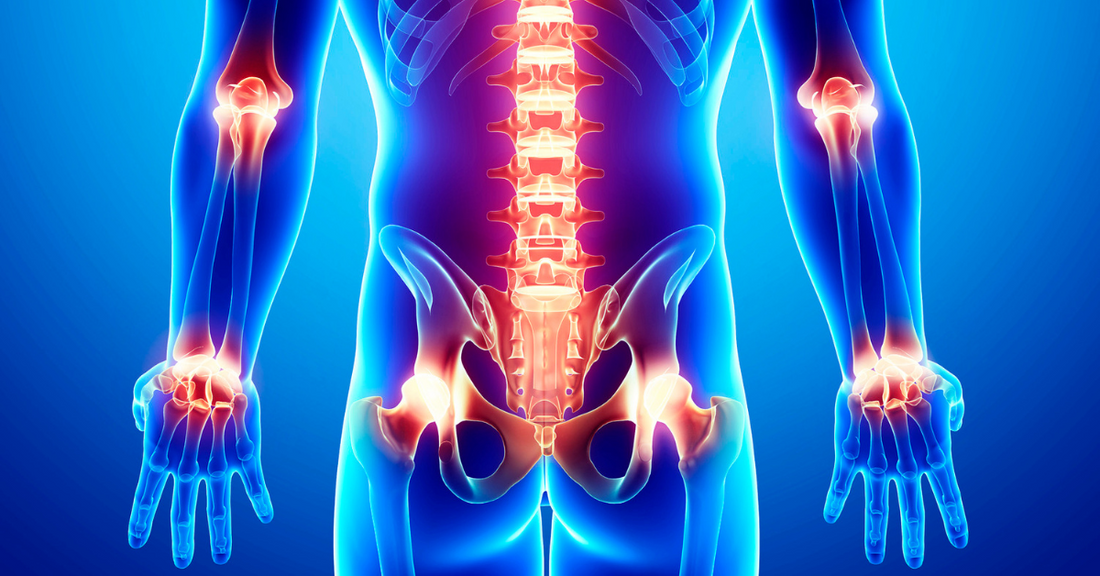 Discover the Power of Turmeric and Ginger- Anti-Inflammatory Superheroes