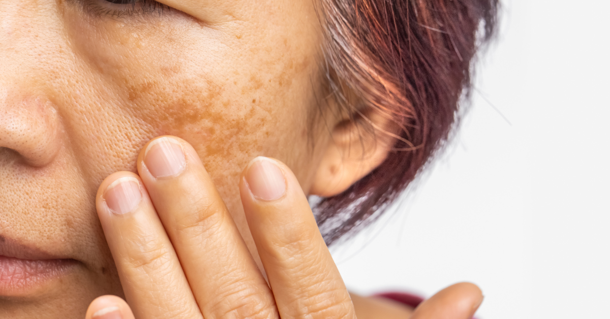 Resveratrol Skin Benefits